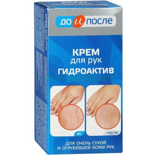 До и после крем для рук 100мл гидроактив